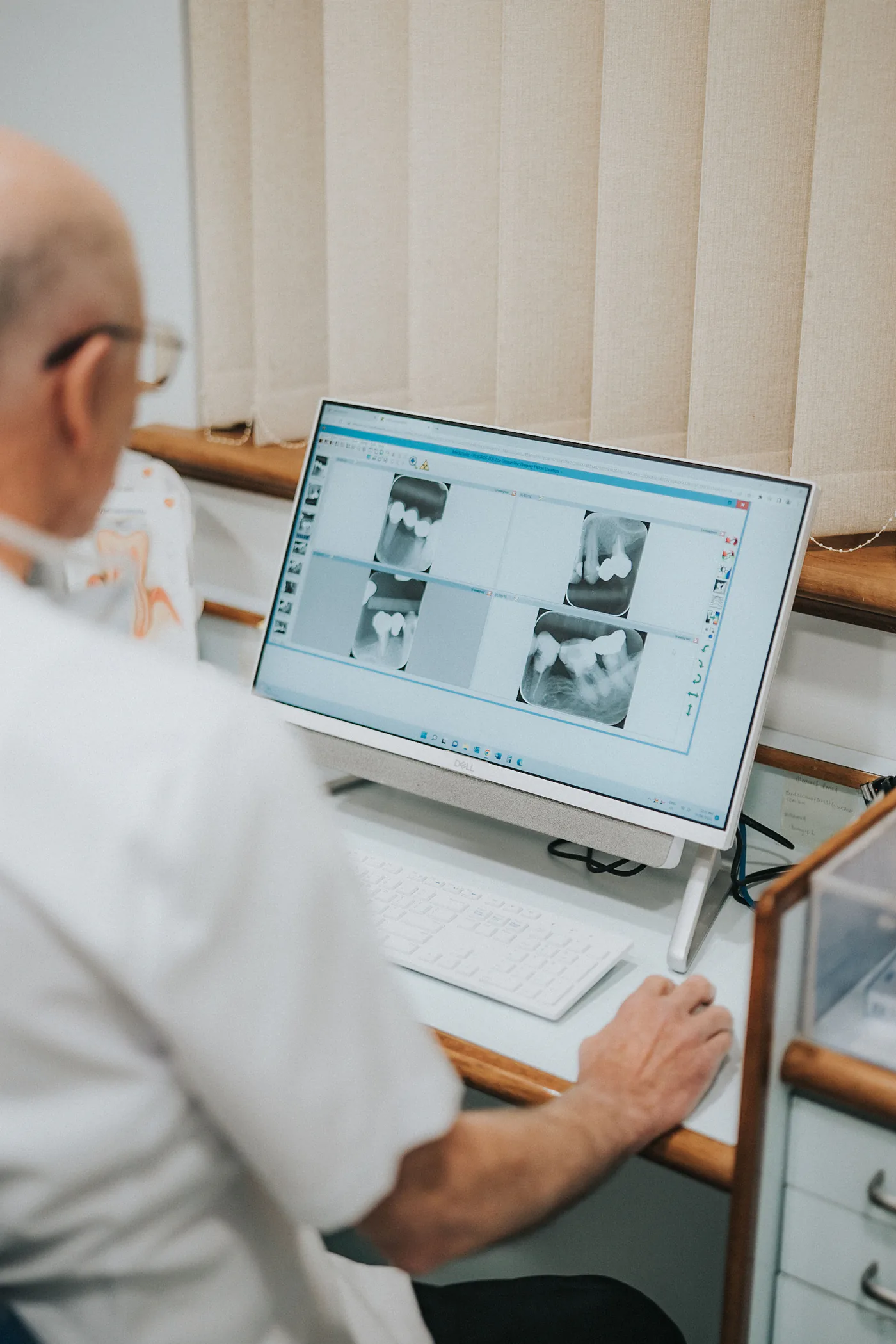 Tooth extractions appointment discussion at Signature Dental
