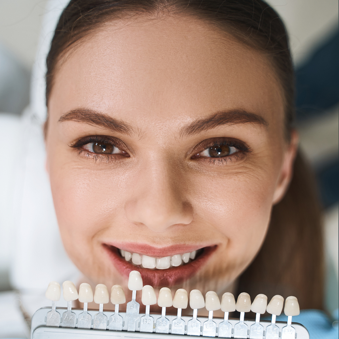 Are Dental Veneers Permanent? Exploring Longevity and Maintenance!